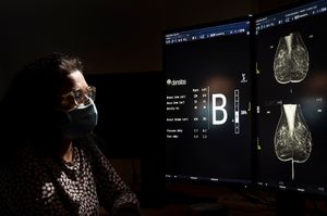 Leeds breast imaging service first in UK to use Densitas intelliMammo artificial intelligence in mammograms