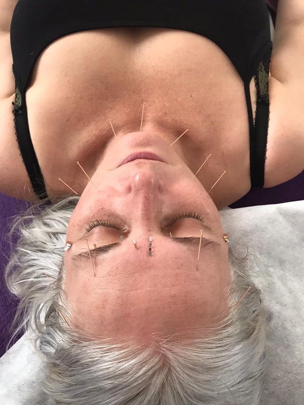 Move over Botox